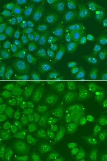 Anti-ANXA8L2 Antibody