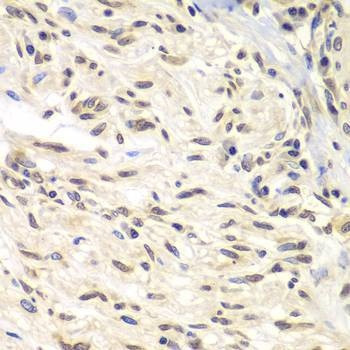 Anti-CHEK1 Antibody