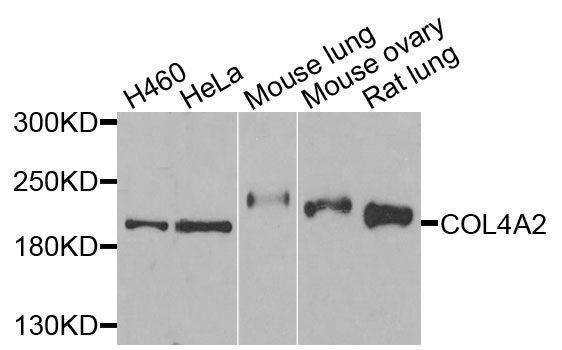 Anti-COL4A2 Antibody