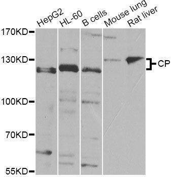 Anti-CP Antibody