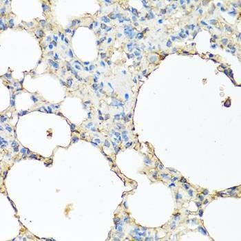 Anti-CP Antibody
