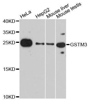 Anti-GSTM3 Antibody
