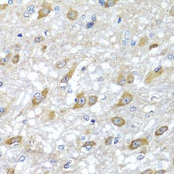 Anti-HSPA6 Antibody