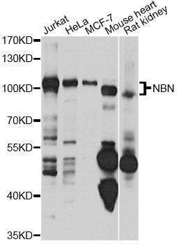 Anti-NBN Antibody