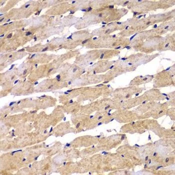 Anti-PSEN2 Antibody