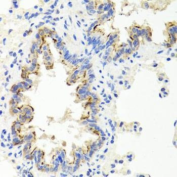 Anti-SHH Antibody