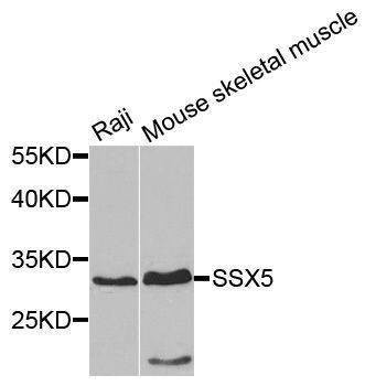 Anti-SSX5 Antibody