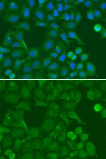 Anti-SSX5 Antibody
