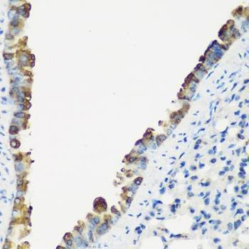 Anti-TNNC2 Antibody