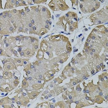 Anti-TRPC3 Antibody