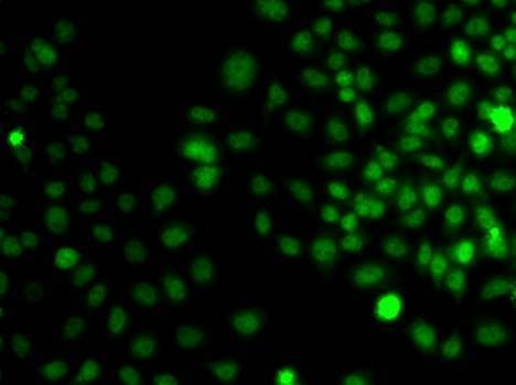 Anti-TRPS1 Antibody