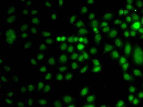 Anti-TRPS1 Antibody