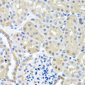 Anti-BSND Antibody