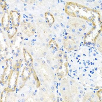 Anti-BSND Antibody
