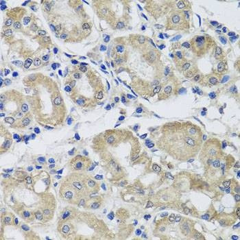 Anti-ST8SIA2 Antibody