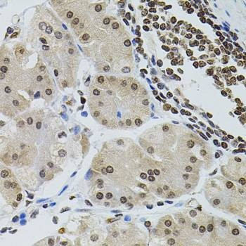Anti-SOCS1 Antibody