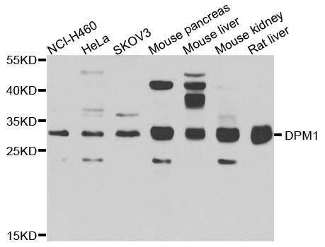 Anti-DPM1 Antibody