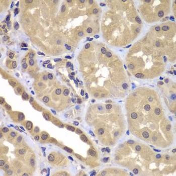 Anti-BAG2 Antibody