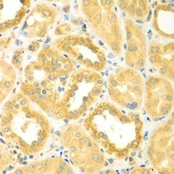 Anti-PDE4DIP Antibody