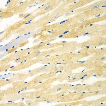 Anti-PDE4DIP Antibody