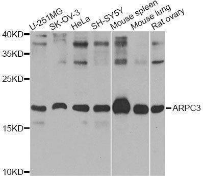 Anti-ARPC3 Antibody