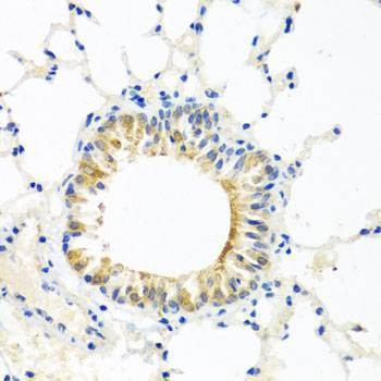 Anti-COQ7 Antibody
