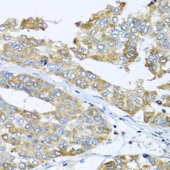 Anti-COQ7 Antibody