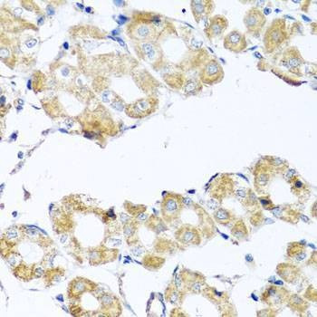 Anti-COQ7 Antibody