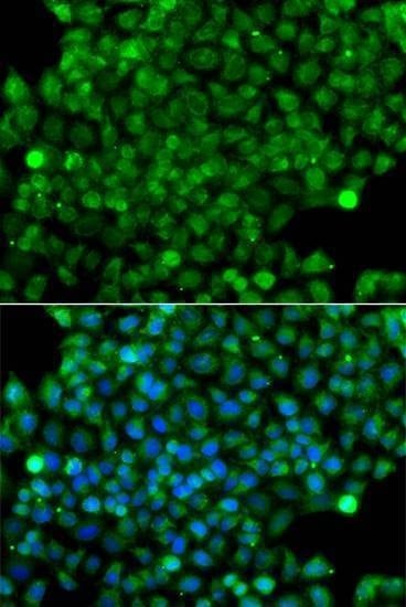 Anti-CFHR3 Antibody