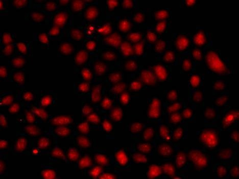 Anti-FBXW11 Antibody
