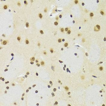 Anti-SUZ12 Antibody