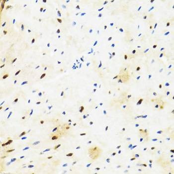 Anti-SUZ12 Antibody