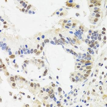 Anti-SUZ12 Antibody