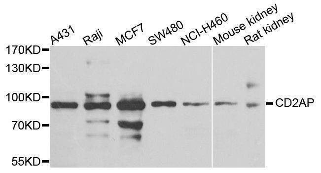 Anti-CD2AP Antibody