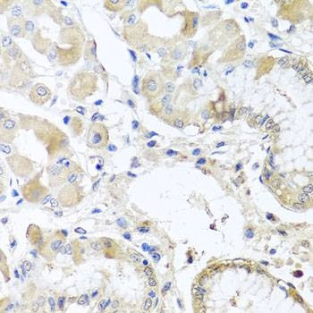 Anti-RPL36 Antibody