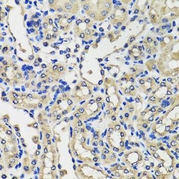Anti-SCG3 Antibody