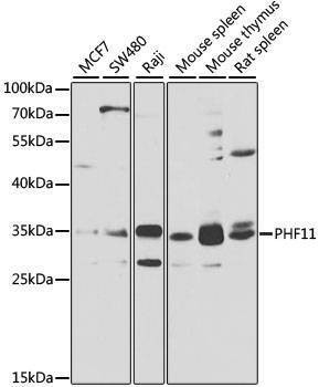Anti-PHF11 Antibody
