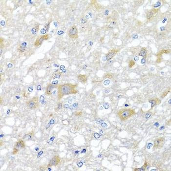 Anti-INPP5K Antibody