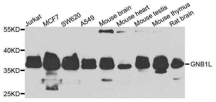 Anti-GNB1L Antibody
