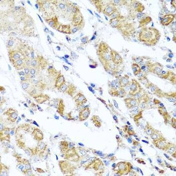 Anti-DARS2 Antibody