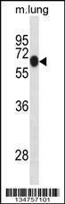 Anti-Mouse Dyrk1b (Center) Antibody