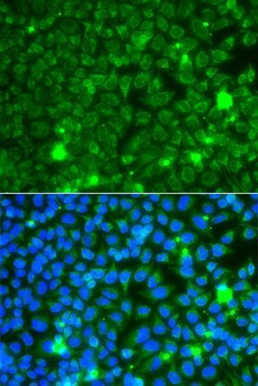 Anti-GBA3 Antibody
