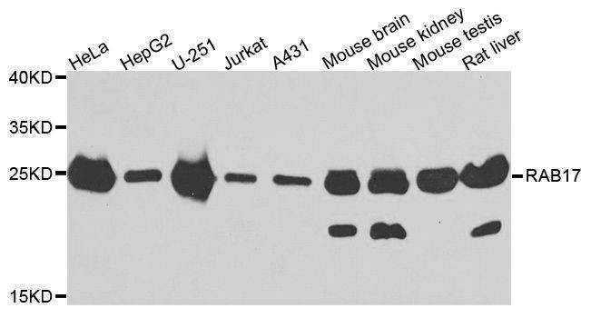 Anti-RAB17 Antibody