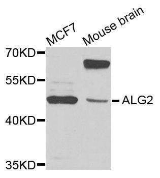 Anti-ALG2 Antibody