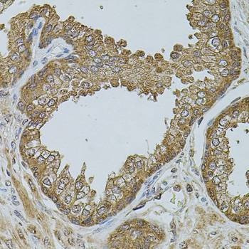 Anti-CHRFAM7A Antibody