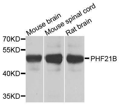 Anti-PHF21B Antibody