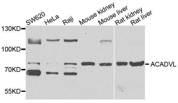 Anti-ACADVL Antibody