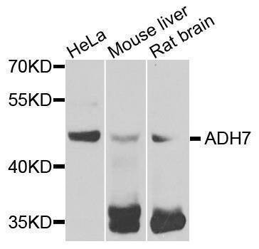 Anti-ADH7 Antibody