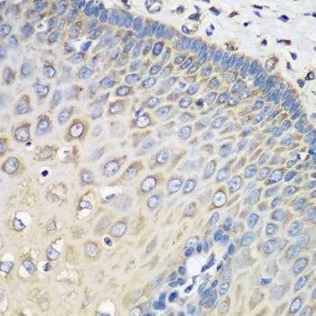 Anti-EEF1G Antibody
