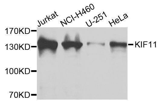 Anti-KIF11 Antibody